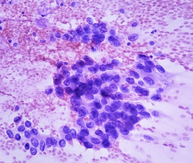 Análisis de citología en laboratorio CEPAT Comodoro Rivadavia